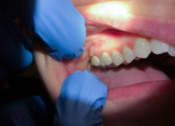 Best Mobile Emergency Dentist in Rio Pinar, FL